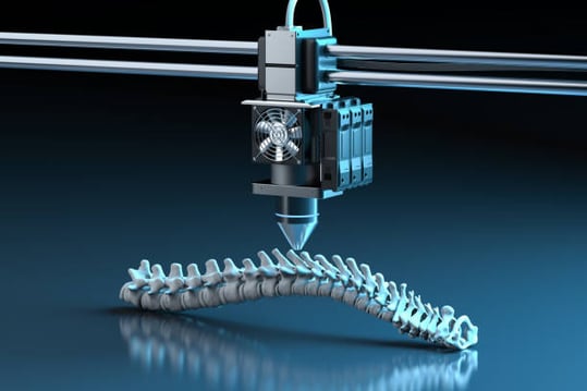 Revolutionizing Medical Manufacturing: The Role of Additive Manufacturing and 3D Printing with APS-ERP Integration-PlanetTogether
